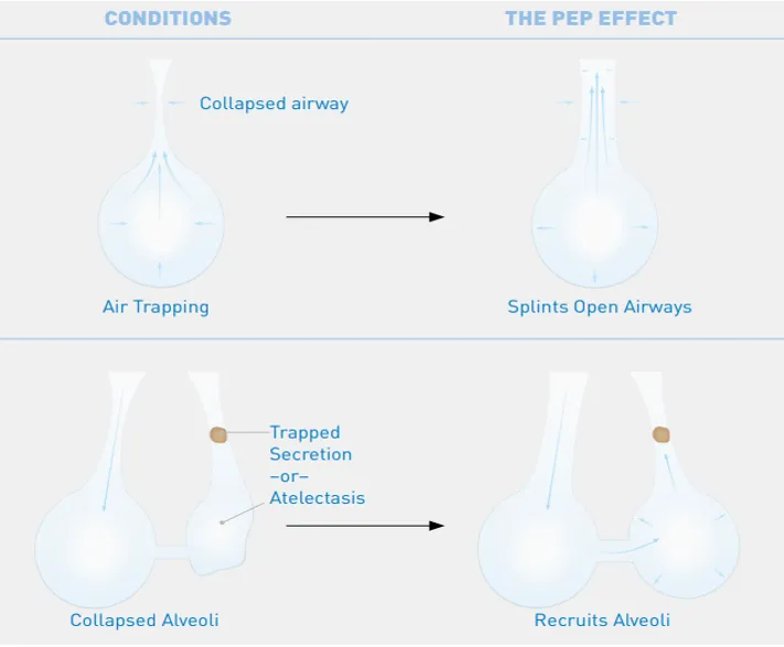 Acapella Choice Vibratory PEP System