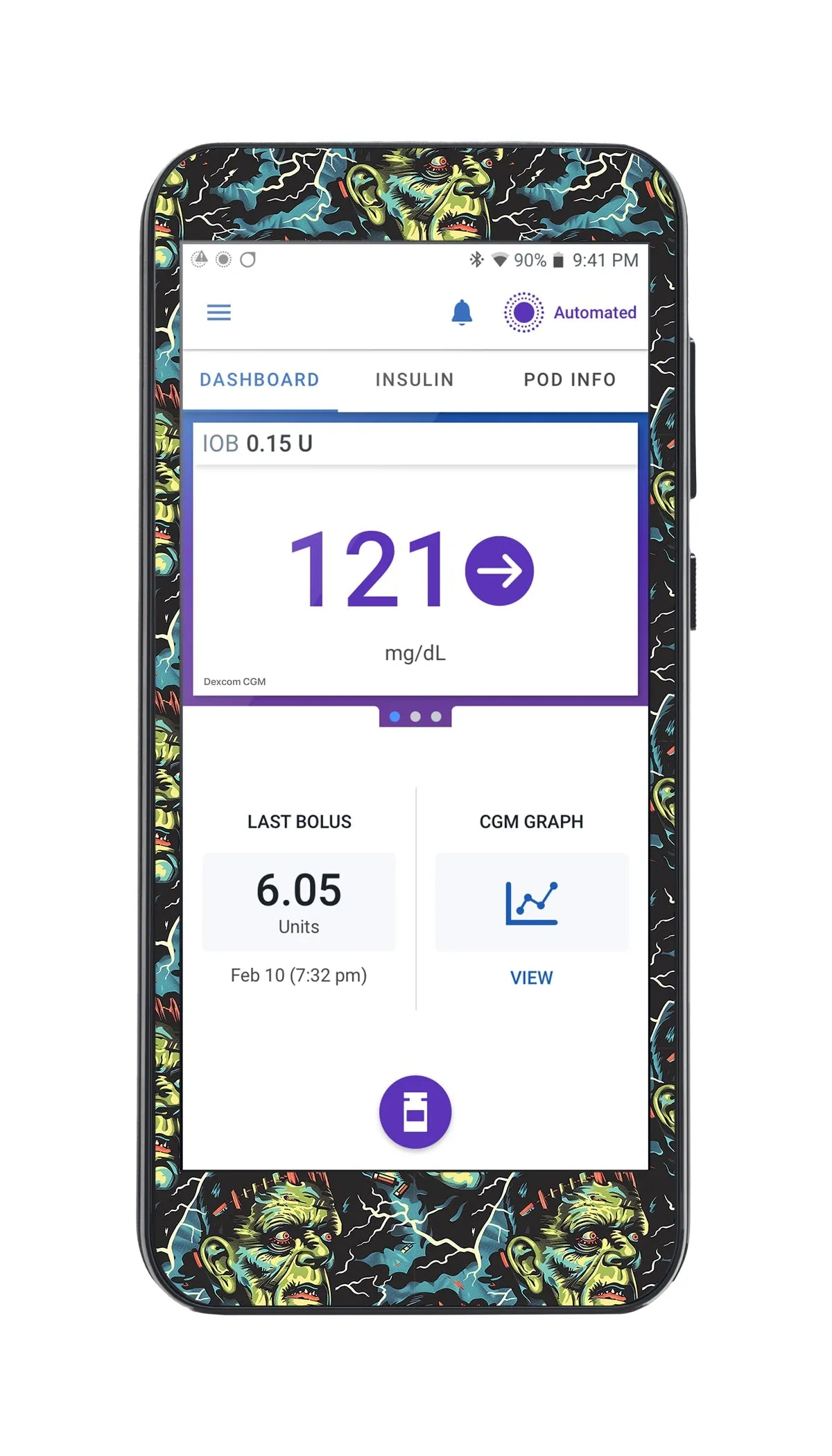 Frankie Omnipod 5™