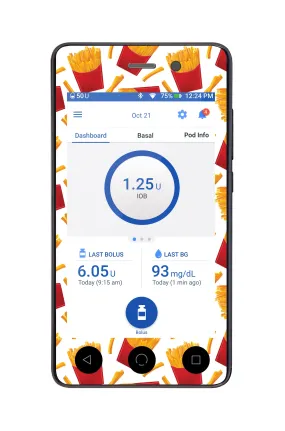 French Fries Omnipod DASH™