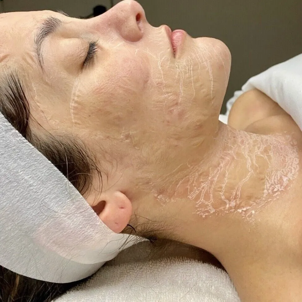 (NEW) Botox Facial